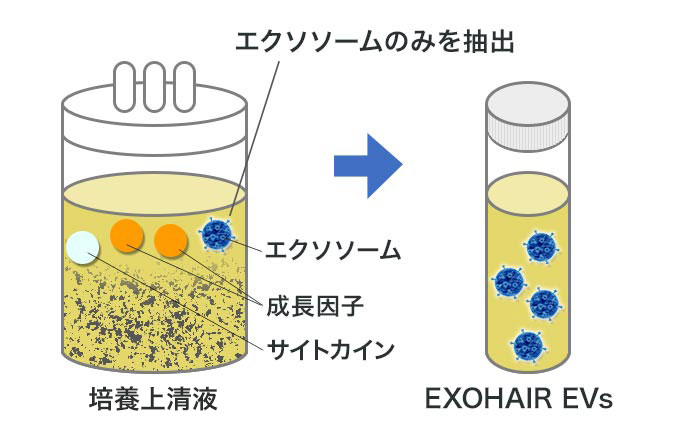 培養上清液からエクソソームのみを抽出